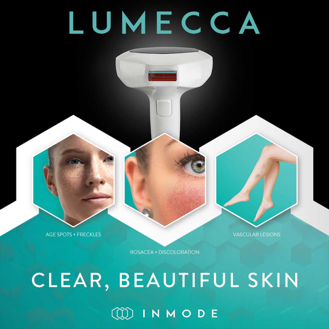 lumecca ipl treatment areas infographic