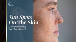 Sun_spots_on_the_skin